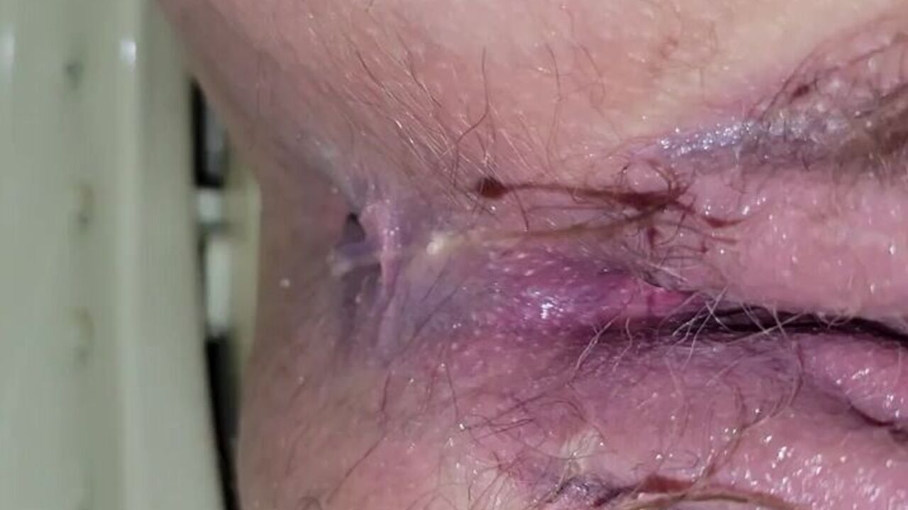 Watch this filthy scat porn video of a scat girl getting drenched in caca