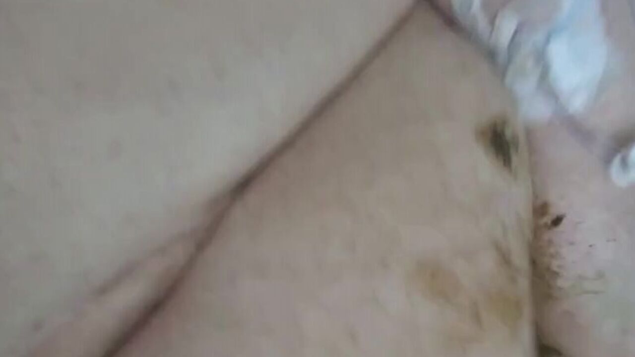 Dirty hospital handjobs are the best way to deal with scat pups