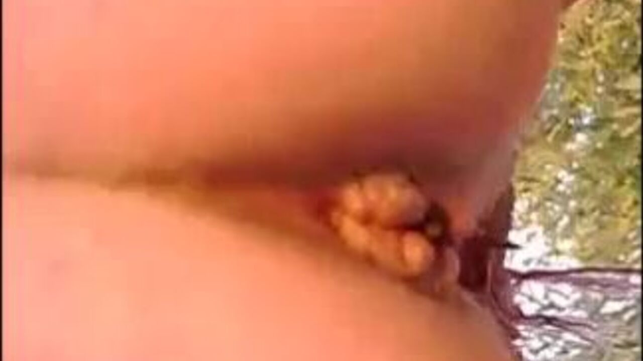 Check out this scat-drenched slut shitting in public view!