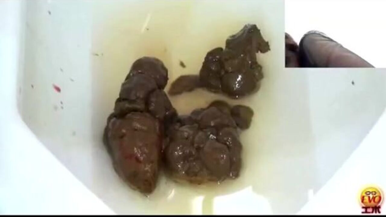 Watch as two kinky sluts get off on scat play and share their kinks on this Dual Perspectives-1-part01 video