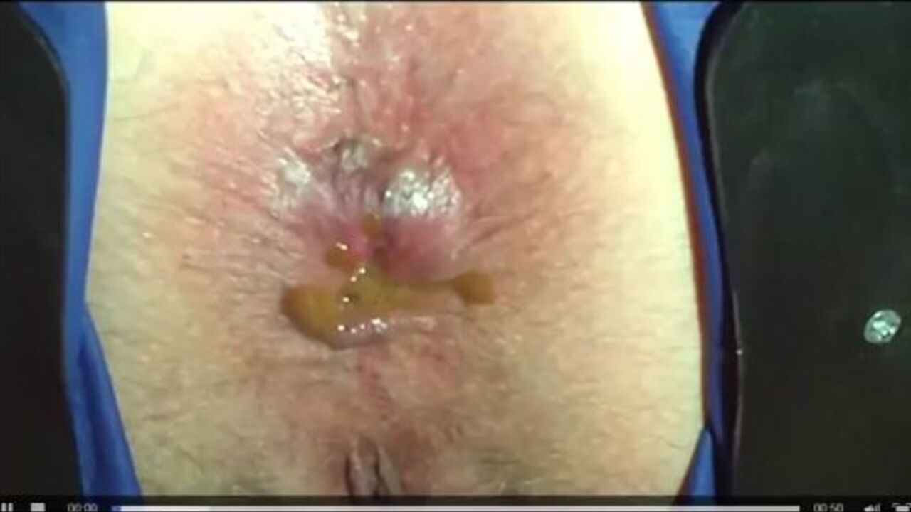 Our Love Shack: A kinky love story of vomiting, scat, and BDSM domination