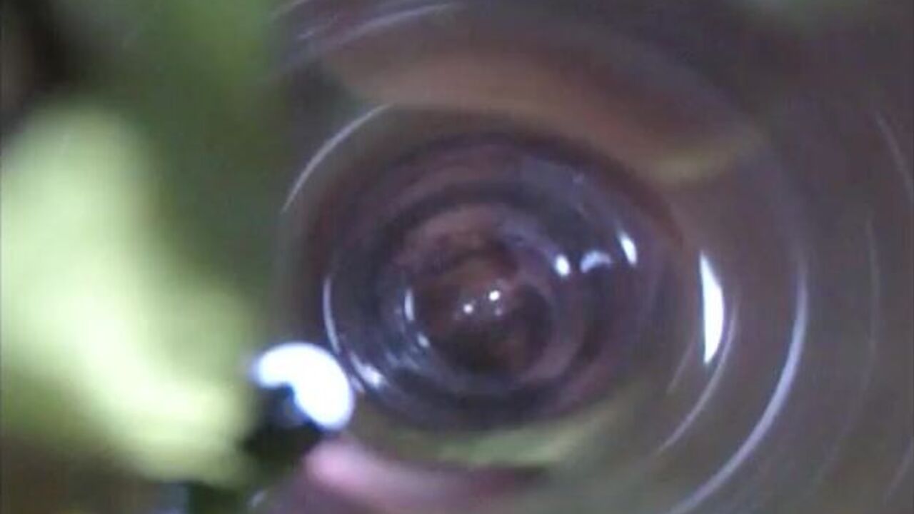 Watch the scat life of Anus in this poop video - inside Observation