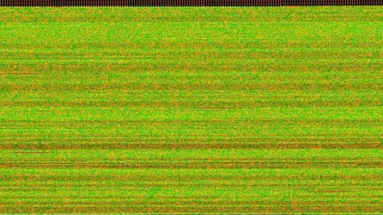 Nurse Self Enema Toilet-part00: The ultimate toilet porn video!