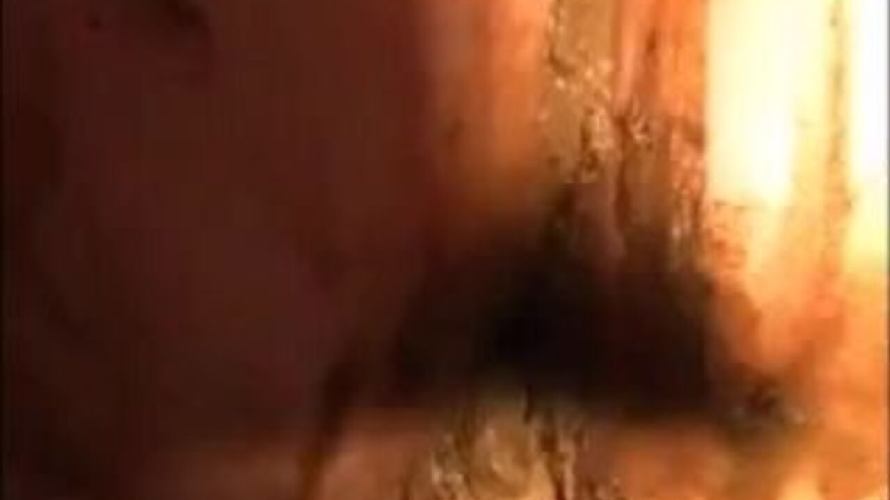 Watch this filthy slut scat and smeared all over her body in this wild scat porn video