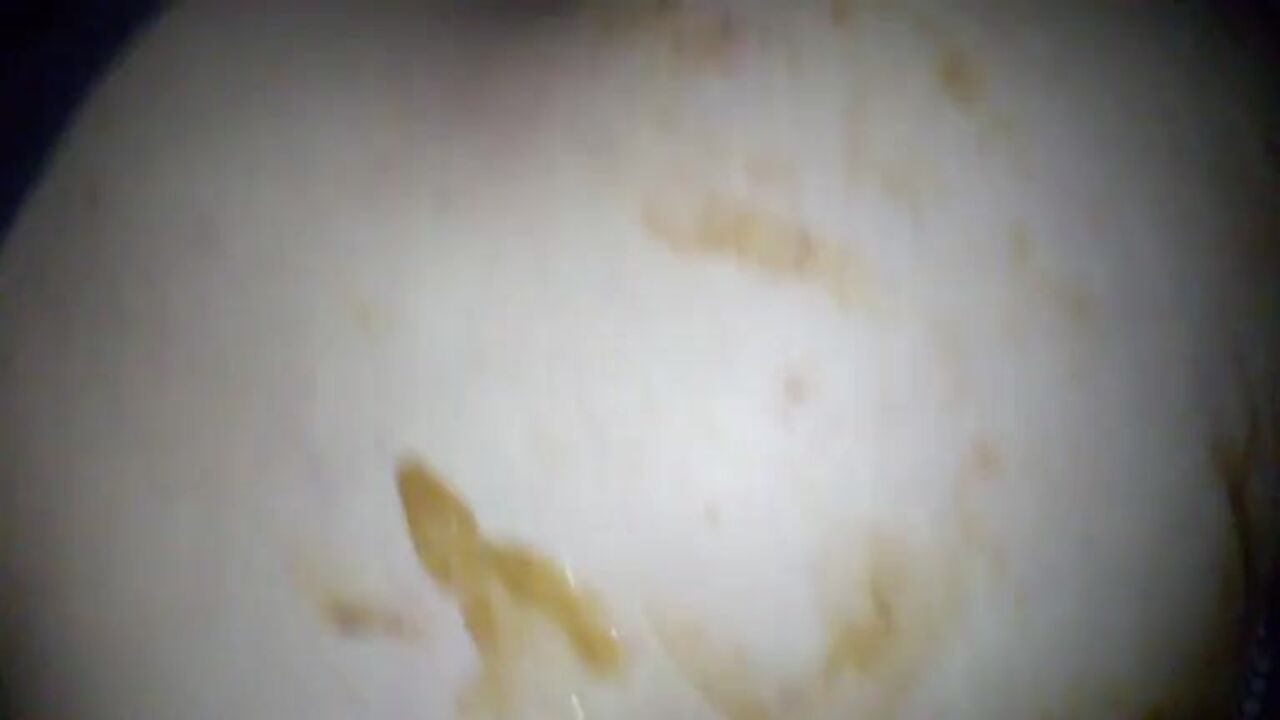 Watch as a filthy slut gets scat virginity in a scat video!