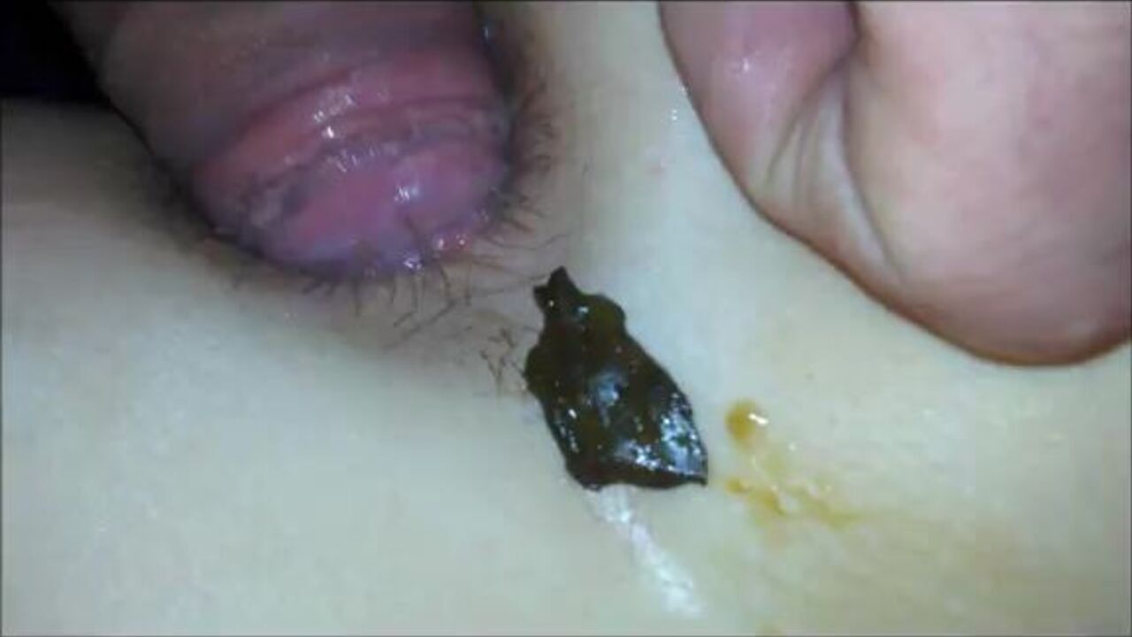 Private amateur slut gets her ass filled with piss and cum in a wild homemade scat ass romp