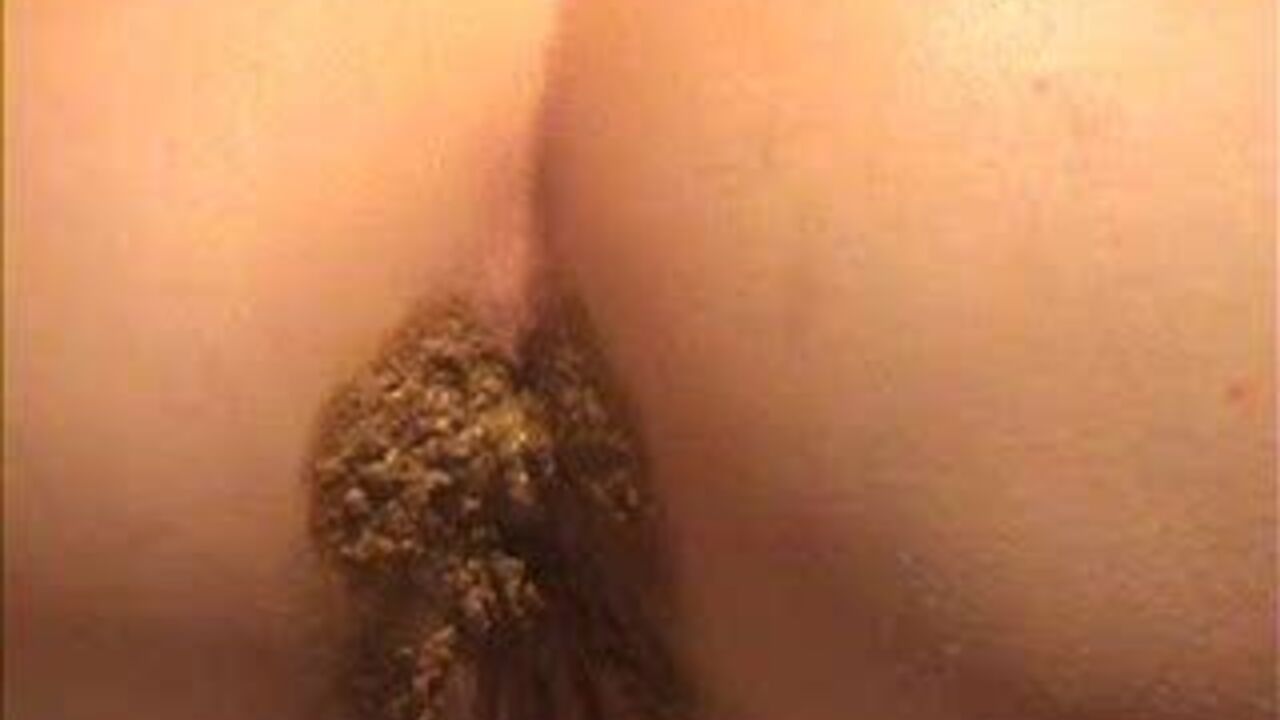 Perfect mix of scat and NASTY FARTS: scat fetish porn with scat girls getting nasty and filthy