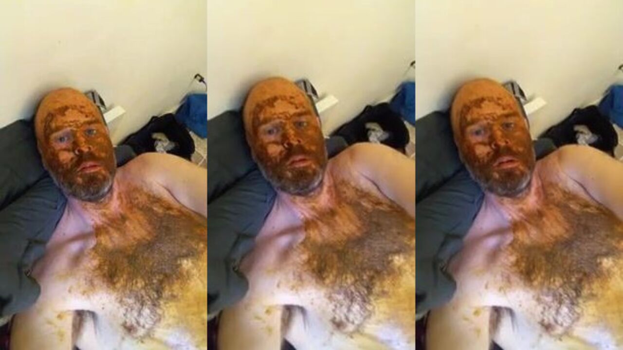 Watch this kinky dude play with his scat like there's no tomorrow