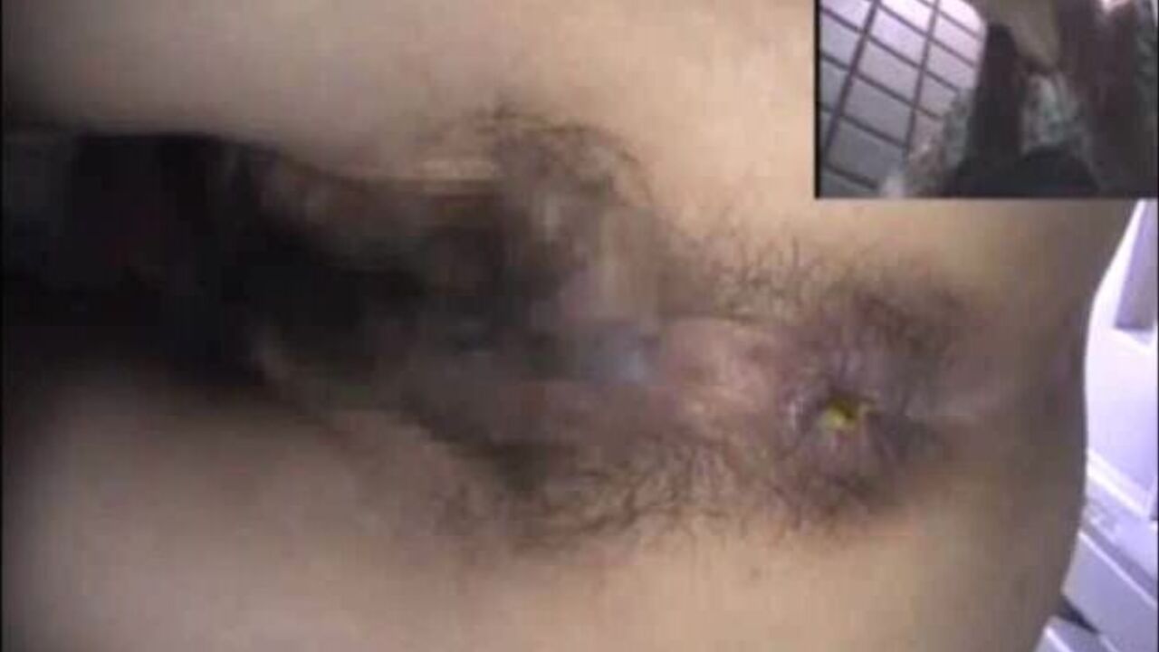 Watch this filthy slut get her assholeviewed and reamed by a huge dick