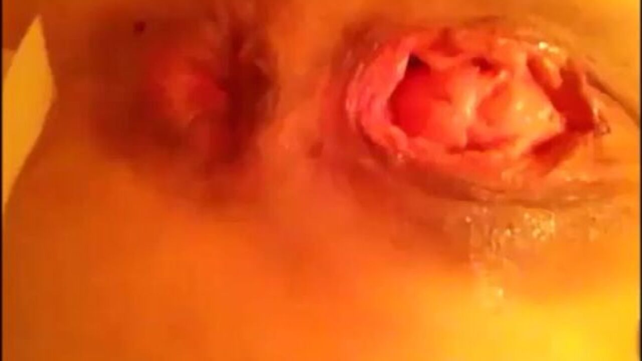 Watch this kinky scat porn video of a prolapsed anal slut self-fisting and taking a little bit of shittin' in her