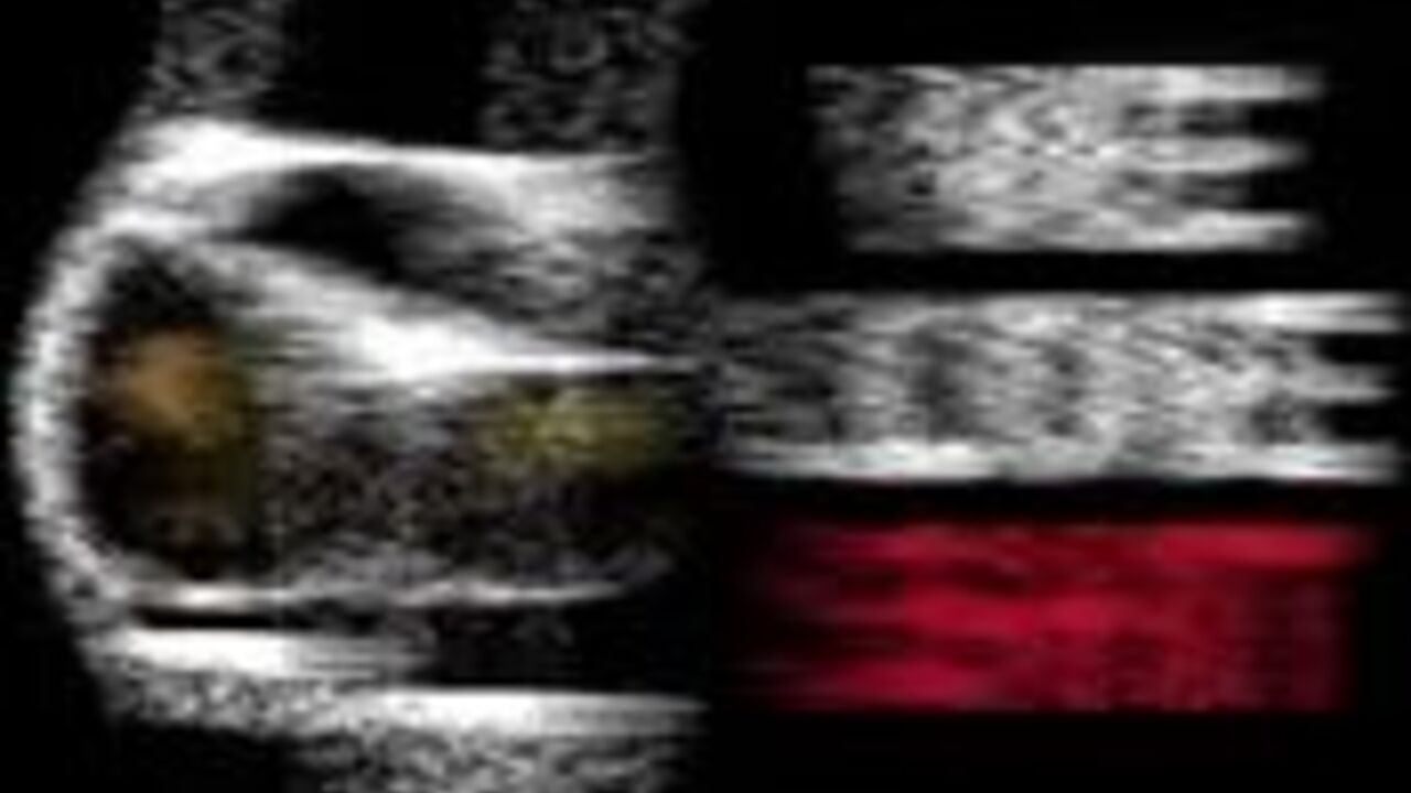 Compilation of filthy love-making with piggy-munching, filthy scat and filthy munching