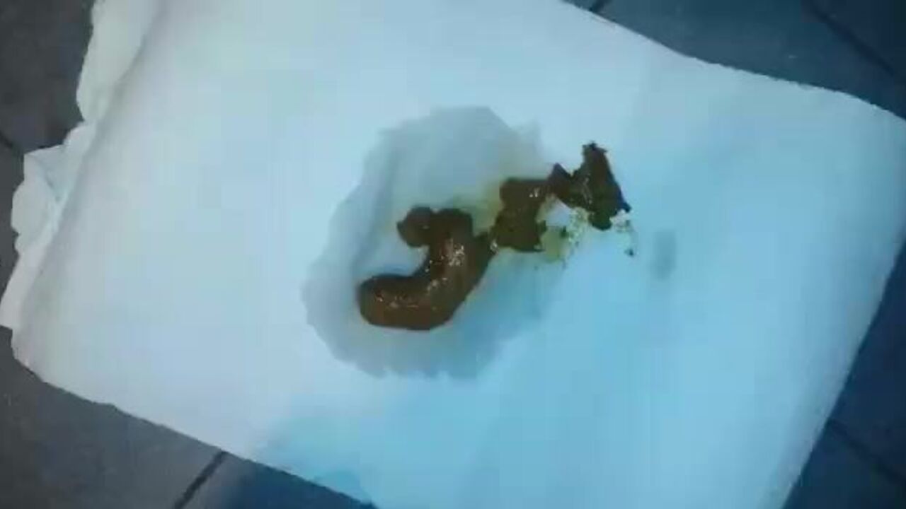 Watch this filthy scat porn video of Best Pooped Scat Girls getting off in a tube