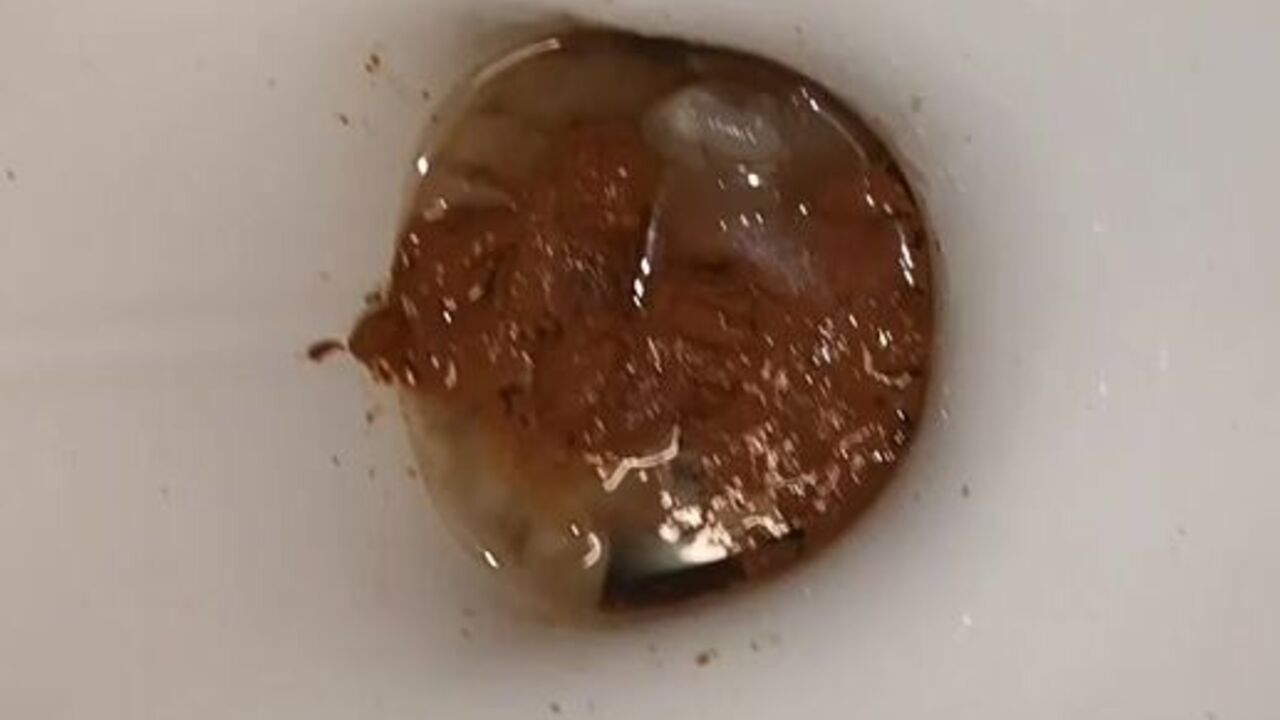 Watch these filthy sluts scat and get dominated in this scat porn video