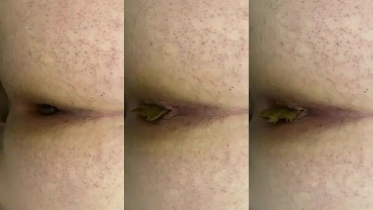 Watch the scariest of kinks: Skat, scat, and more!