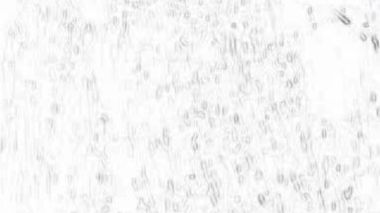 Get up close and personal with the dirty scat of your life