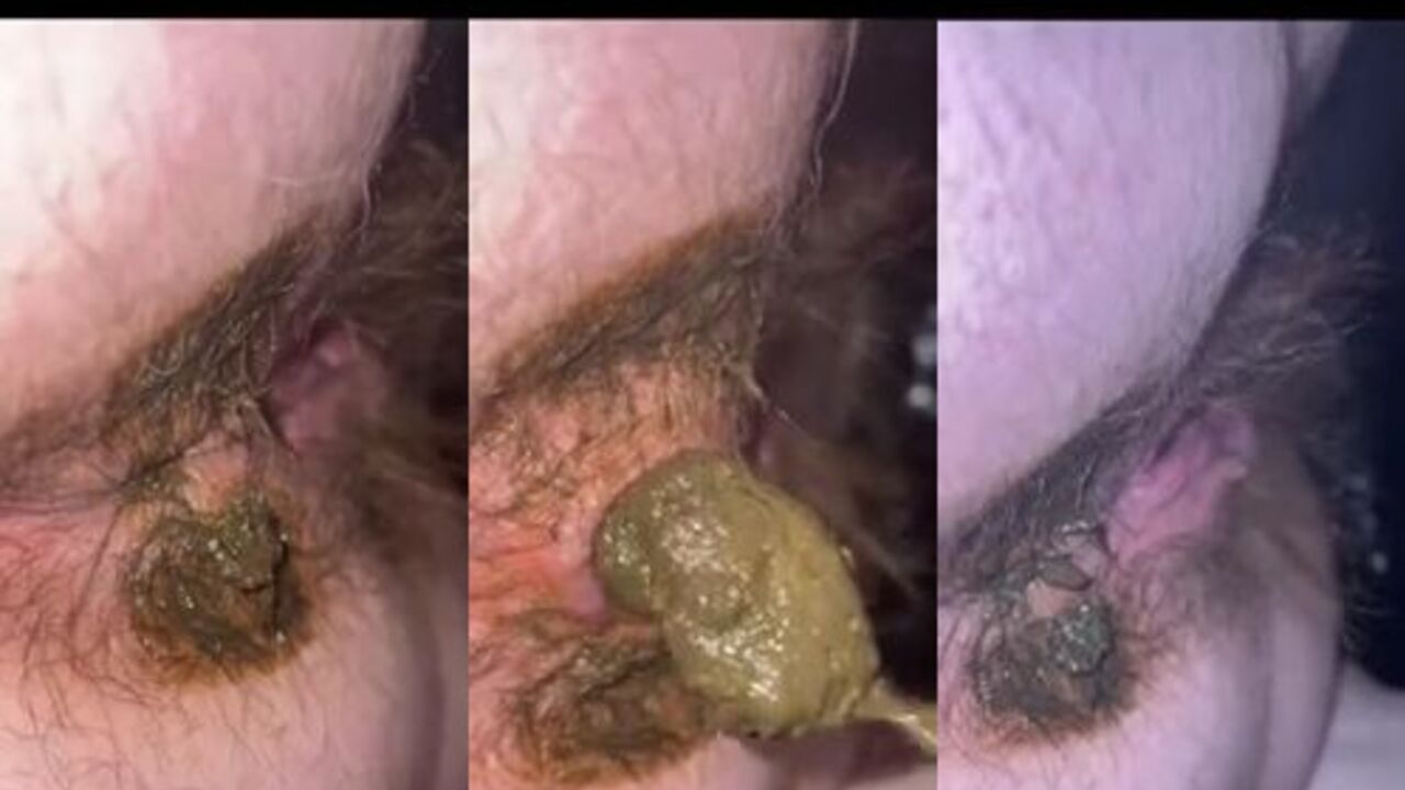Get a close-up view of this filthy slut's scat, including her shitting and pooping out